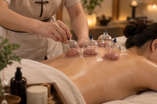 Cupping service